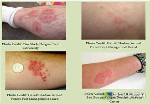 (출처: Tackling bed bugs; A starter guide for local governments)